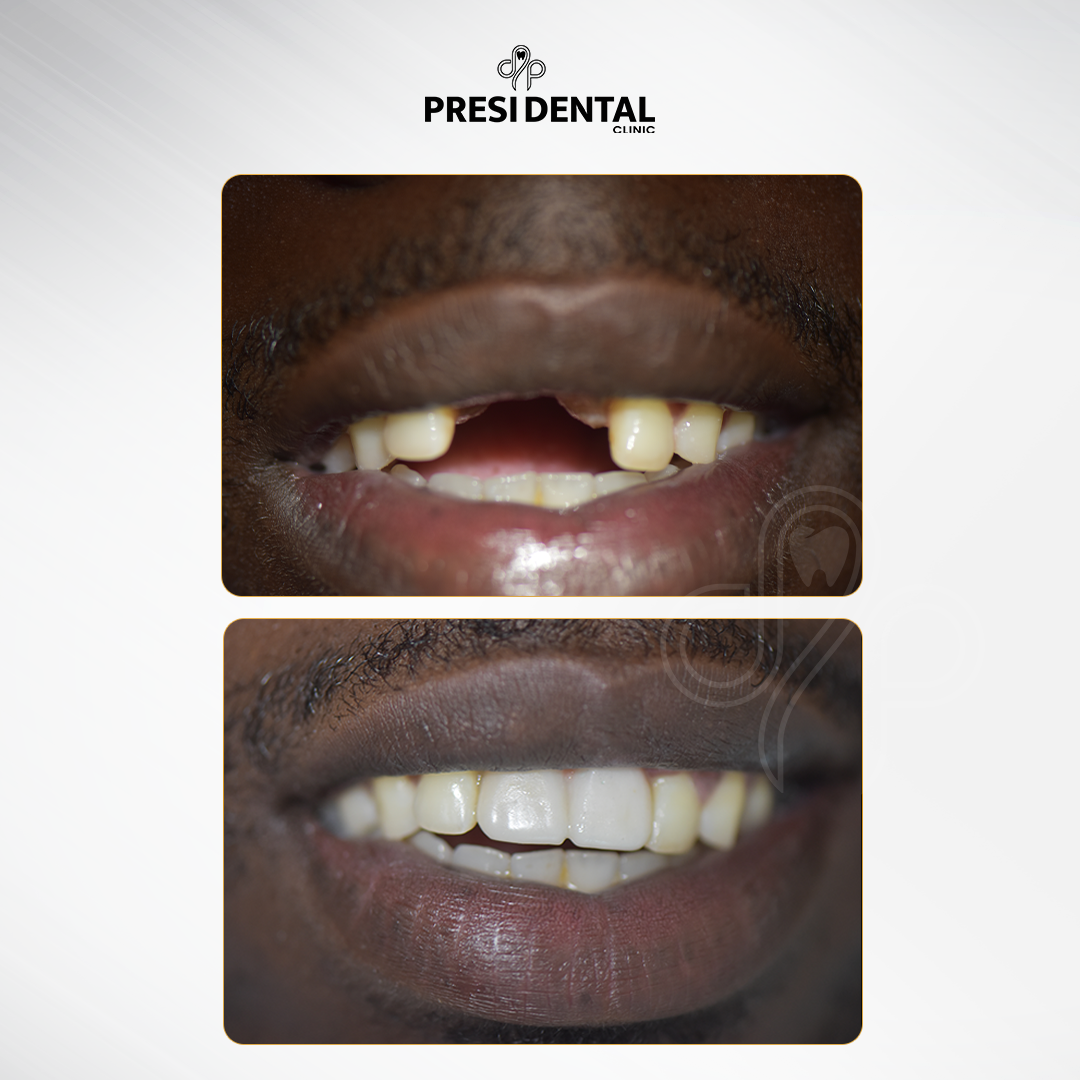 B&A 1