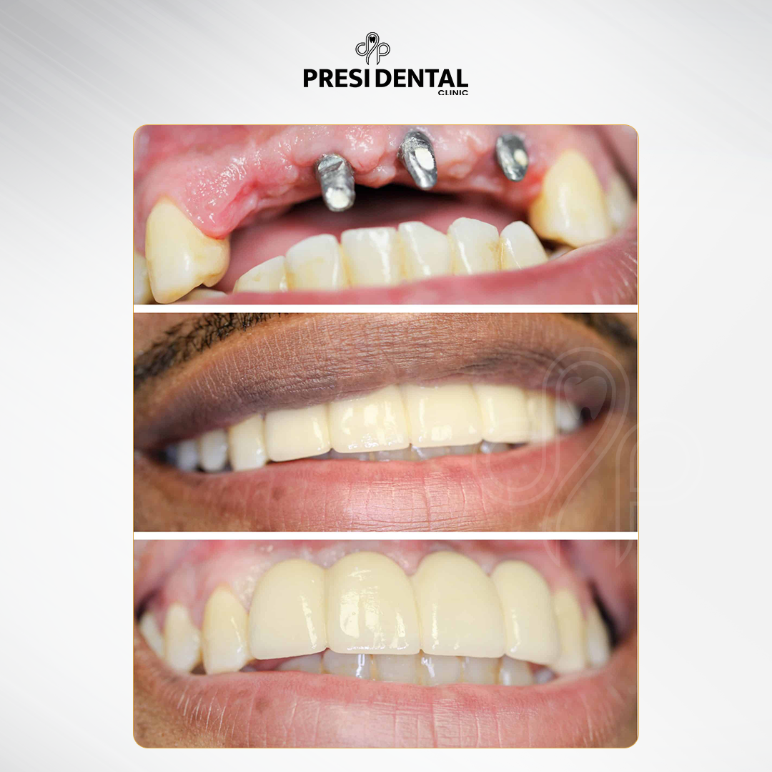 B&A 4